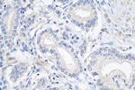 ALKBH3 Antibody in Immunohistochemistry (Paraffin) (IHC (P))