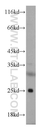 ALKBH3 Antibody in Western Blot (WB)
