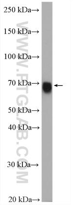 GATAD2A Antibody in Western Blot (WB)