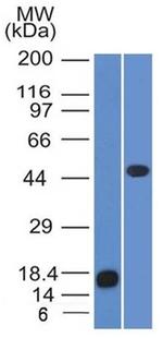 Adipophilin/Perilipin-2 Monoclonal Antibody (ADFP, 1365)