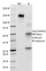 Adipophilin/Perilipin-2 Antibody in SDS-PAGE (SDS-PAGE)
