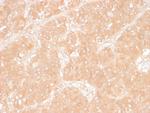 Adipophilin/Perilipin-2 Monoclonal Antibody (ADFP, 1366)