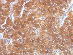 Adipophilin/Perilipin-2 (Marker of Lipid Accumulation) Monoclonal Antibody (ADFP/1494)