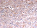 Adipophilin/Perilipin-2 Recombinant Mouse Monoclonal Antibody (rADFP, 1493)