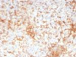 Adipophilin/Perilipin-2 (Marker of Lipid Accumulation) Recombinant Mouse Monoclonal Antibody (rADFP/9321)
