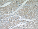 ITGB1BP1 Antibody in Immunohistochemistry (Paraffin) (IHC (P))