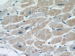 ITGB1BP1 Antibody in Immunohistochemistry (Paraffin) (IHC (P))