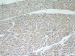 ITGB1BP1 Antibody in Immunohistochemistry (Paraffin) (IHC (P))