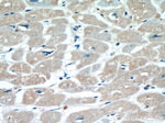 ITGB1BP1 Antibody in Immunohistochemistry (Paraffin) (IHC (P))