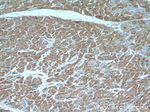 ITGB1BP1 Antibody in Immunohistochemistry (Paraffin) (IHC (P))