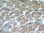 ITGB1BP1 Antibody in Immunohistochemistry (Paraffin) (IHC (P))