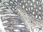ITGB1BP1 Antibody in Immunohistochemistry (Paraffin) (IHC (P))