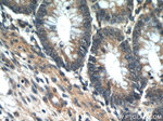 ITGB1BP1 Antibody in Immunohistochemistry (Paraffin) (IHC (P))