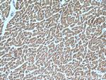ITGB1BP1 Antibody in Immunohistochemistry (Paraffin) (IHC (P))