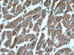 ITGB1BP1 Antibody in Immunohistochemistry (Paraffin) (IHC (P))
