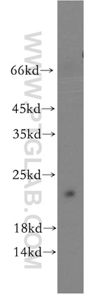 ITGB1BP1 Antibody in Western Blot (WB)