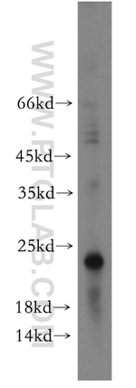 ITGB1BP1 Antibody in Western Blot (WB)