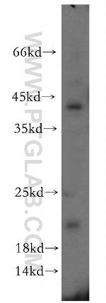ITGB1BP1 Antibody in Western Blot (WB)