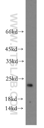 ITGB1BP1 Antibody in Western Blot (WB)