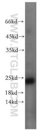 ITGB1BP1 Antibody in Western Blot (WB)