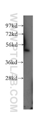 ASCC1 Antibody in Western Blot (WB)