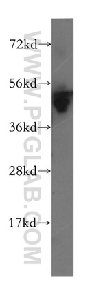 ASCC1 Antibody in Western Blot (WB)