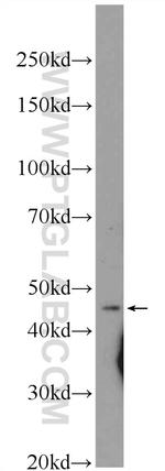 ASCC1 Antibody in Western Blot (WB)