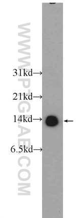 TBCA Antibody in Western Blot (WB)