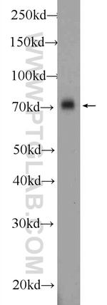 APLP1 Antibody in Western Blot (WB)