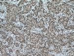 HRPT2 Antibody in Immunohistochemistry (Paraffin) (IHC (P))