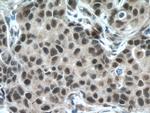 HRPT2 Antibody in Immunohistochemistry (Paraffin) (IHC (P))
