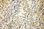 HRPT2 Antibody in Immunohistochemistry (Paraffin) (IHC (P))
