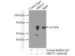 HRPT2 Antibody in Immunoprecipitation (IP)