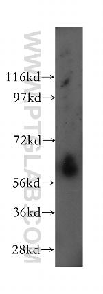 HRPT2 Antibody in Western Blot (WB)
