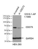 HRPT2 Antibody in Western Blot (WB)