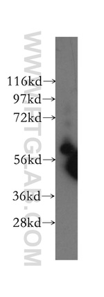 HRPT2 Antibody in Western Blot (WB)