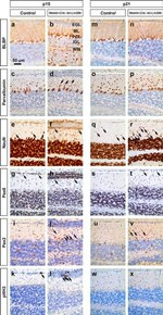 PAX2 Antibody in Immunohistochemistry (Paraffin) (IHC (P))