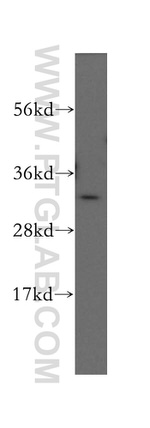 GNPDA1 Antibody in Western Blot (WB)