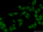 KIN17 Antibody in Immunocytochemistry (ICC/IF)