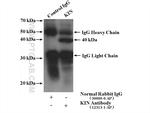 KIN17 Antibody in Immunoprecipitation (IP)
