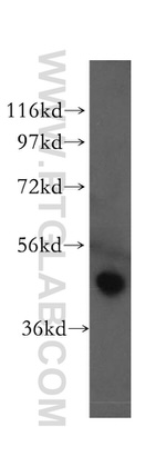 KIN17 Antibody in Western Blot (WB)