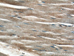 CRB3 Antibody in Immunohistochemistry (Paraffin) (IHC (P))