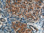 CRB3 Antibody in Immunohistochemistry (Paraffin) (IHC (P))