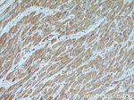 ANGPTL2 Antibody in Immunohistochemistry (Paraffin) (IHC (P))