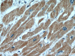 ANGPTL2 Antibody in Immunohistochemistry (Paraffin) (IHC (P))