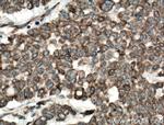 ANGPTL2 Antibody in Immunohistochemistry (Paraffin) (IHC (P))
