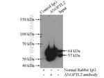 ANGPTL2 Antibody in Immunoprecipitation (IP)