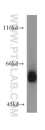 ANGPTL2 Antibody in Western Blot (WB)
