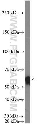ANGPTL2 Antibody in Western Blot (WB)