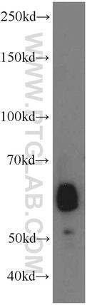 ANGPTL2 Antibody in Western Blot (WB)